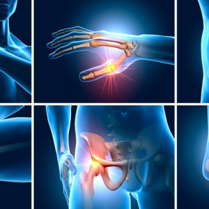 MSM que apoya la salud articular y reduce la inflamación. Fortalece cabello, piel y uñas, y favorece la recuperación muscular. Con propiedades antioxidantes e inmunológicas.