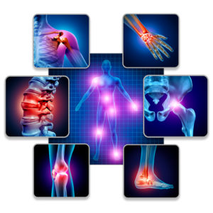La glucosamina apoya la salud articular y puede aliviar el dolor por artritis. Ayuda a regenerar el cartílago y a frenar el desgaste en casos de artrosis.